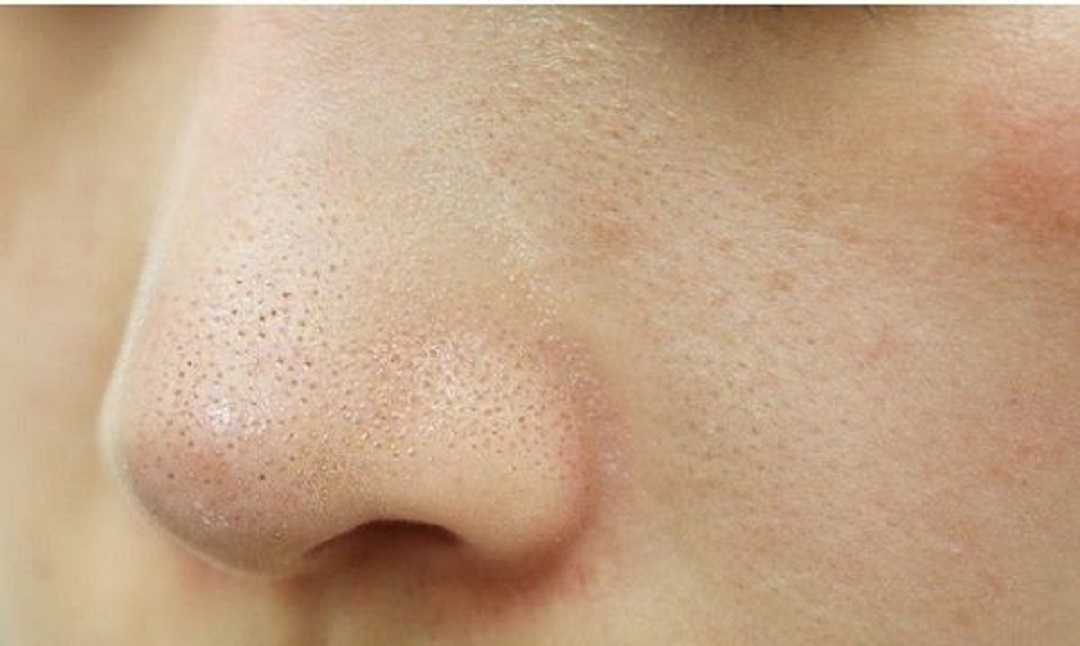 Chữa lành và phục hồi làn da hư tổn