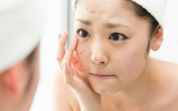 bí quyết cấp ẩm an toàn